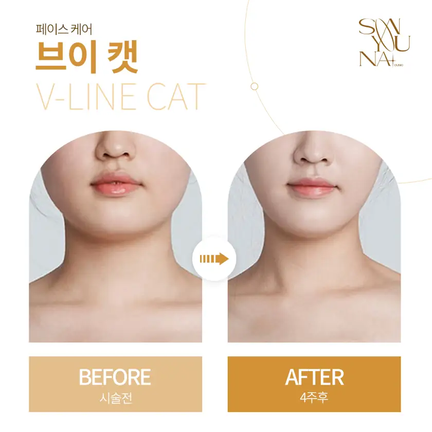 닥터손유나의원 배너 상세 이미지 10