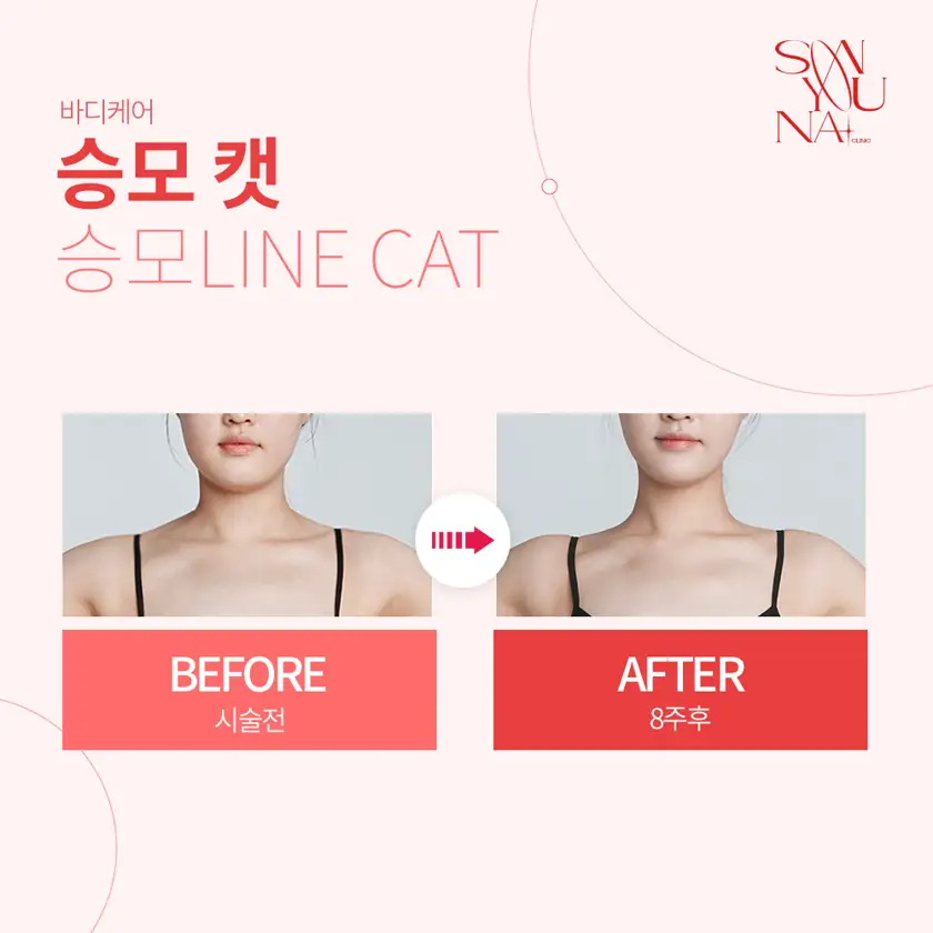 닥터손유나의원 배너 상세 이미지 2