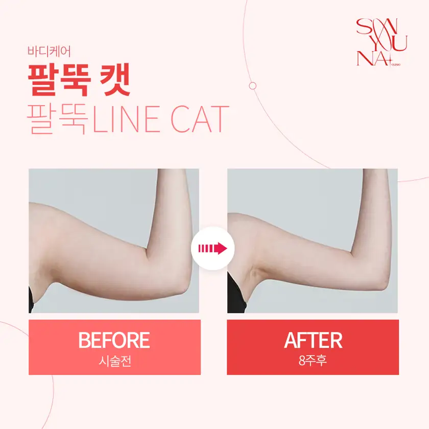 닥터손유나의원 배너 상세 이미지 3