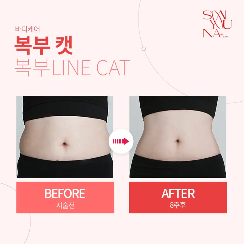 닥터손유나의원 배너 상세 이미지 4
