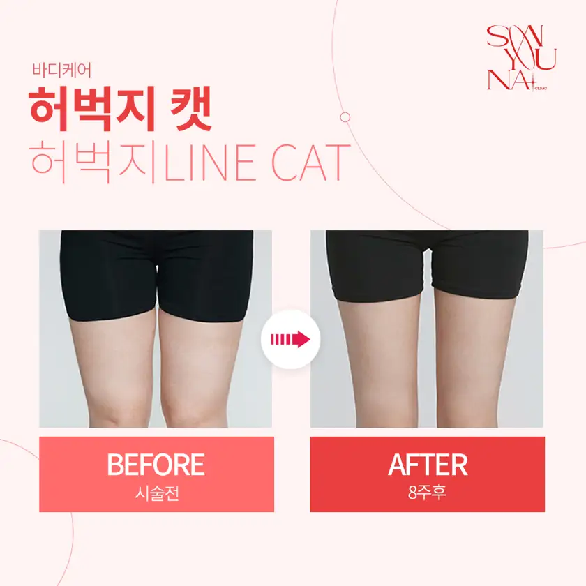 닥터손유나의원 배너 상세 이미지 5
