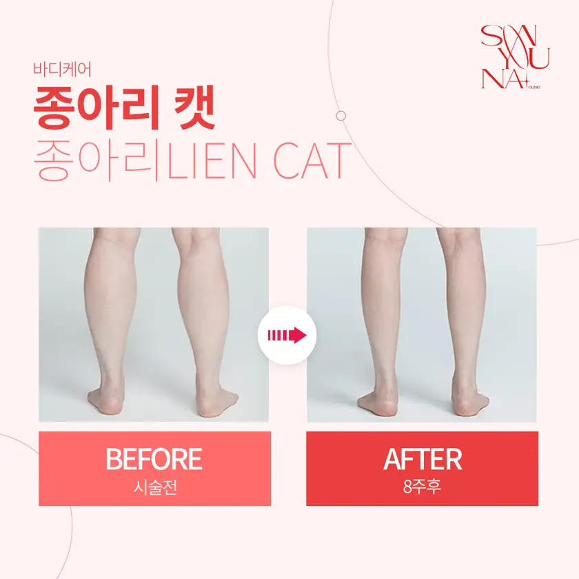 닥터손유나의원 배너 상세 이미지 6