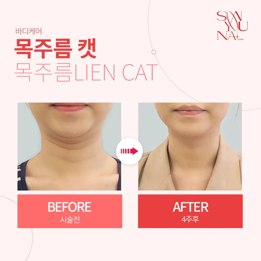 닥터손유나의원 배너 상세 이미지 7