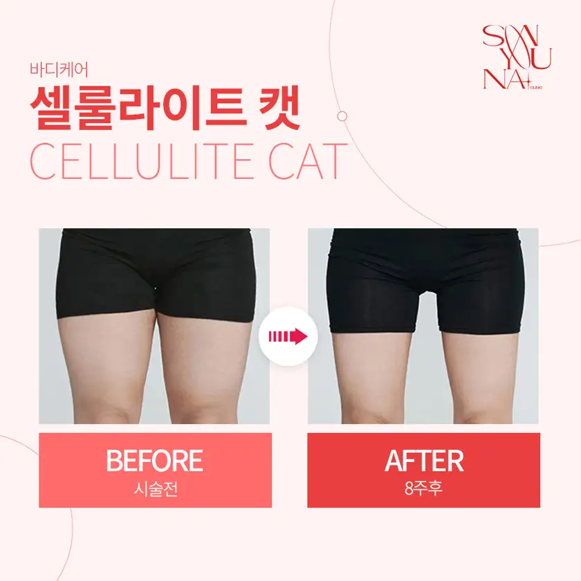 닥터손유나의원 배너 상세 이미지 8