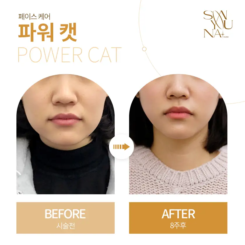 닥터손유나의원 배너 상세 이미지 9