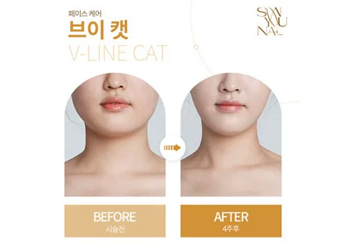 닥터손유나의원 배너 작업 이미지